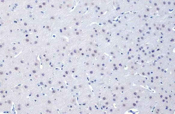 OGT Antibody in Immunohistochemistry (Paraffin) (IHC (P))