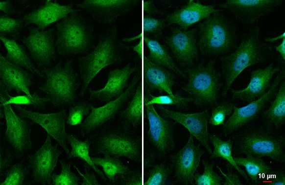 OGT Antibody in Immunocytochemistry (ICC/IF)