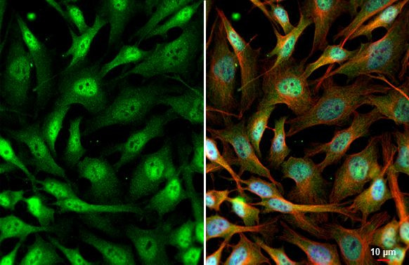 SETDB1 Antibody in Immunocytochemistry (ICC/IF)