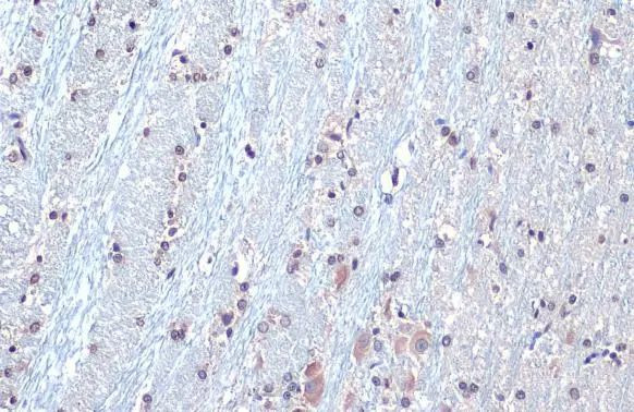 SOD1 Antibody in Immunohistochemistry (Paraffin) (IHC (P))