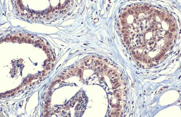 SOD1 Antibody in Immunohistochemistry (Paraffin) (IHC (P))