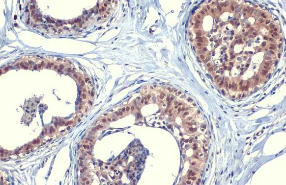 SOD1 Antibody in Immunohistochemistry (Paraffin) (IHC (P))