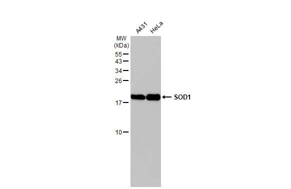 SOD1 Antibody in Western Blot (WB)