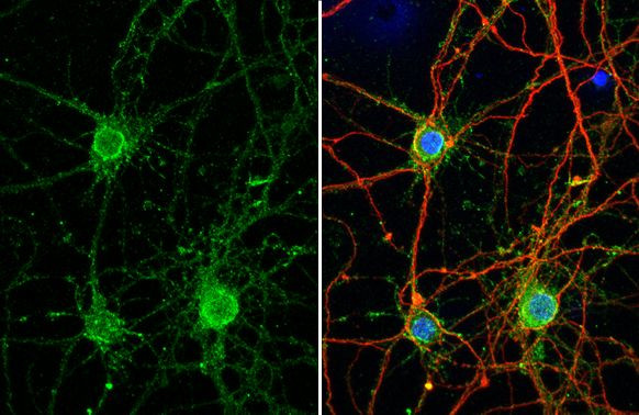 Synaptotagmin 1 Antibody in Immunocytochemistry (ICC/IF)