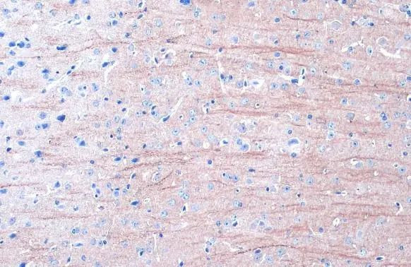 MAP2 Antibody in Immunohistochemistry (Paraffin) (IHC (P))