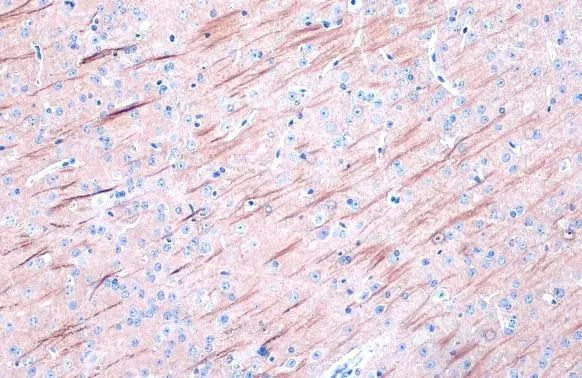 MAP2 Antibody in Immunohistochemistry (Paraffin) (IHC (P))