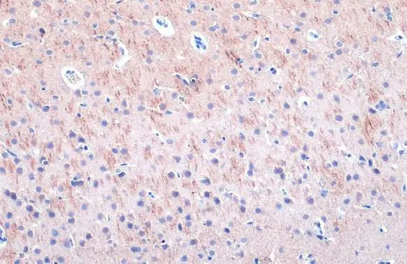 MAP2 Antibody in Immunohistochemistry (Paraffin) (IHC (P))