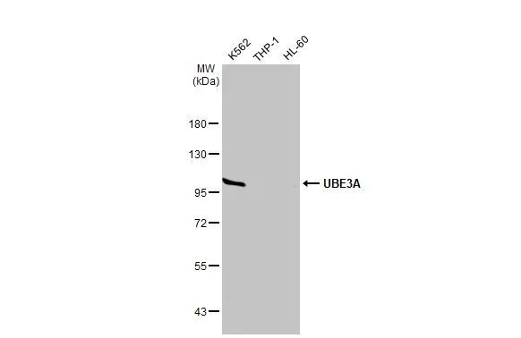 E6AP Antibody in Western Blot (WB)