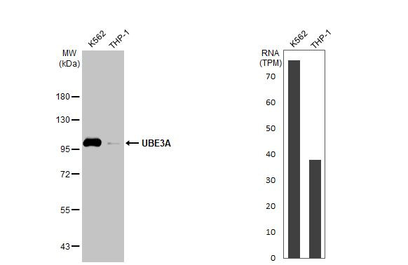 E6AP Antibody in Western Blot (WB)