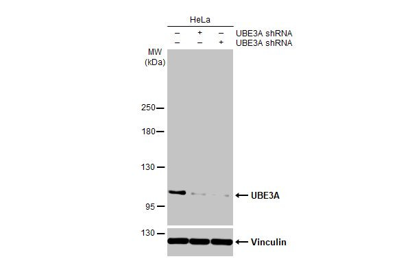 E6AP Antibody in Western Blot (WB)