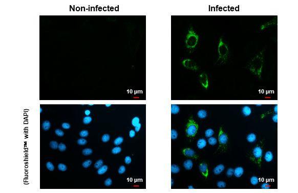 Zika Virus NS4B Antibody in Immunocytochemistry (ICC/IF)