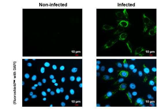 Zika Virus NS4B Antibody in Immunocytochemistry (ICC/IF)