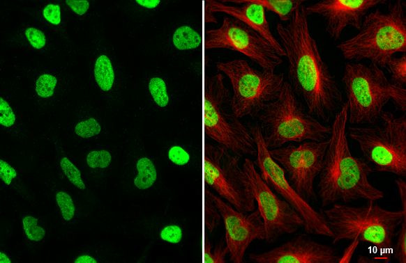 GTF2I Antibody in Immunocytochemistry (ICC/IF)