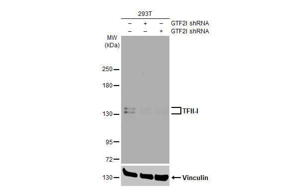 GTF2I Antibody in Western Blot (WB)