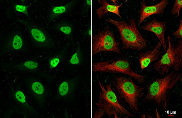 HDAC1 Antibody in Immunocytochemistry (ICC/IF)