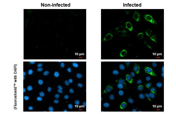 Zika Virus Envelope Antibody in Immunocytochemistry (ICC/IF)