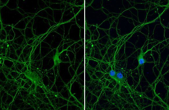 Beta III Tubulin Antibody in Immunocytochemistry (ICC/IF)