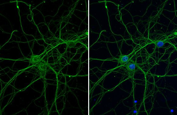 Beta III Tubulin Antibody in Immunocytochemistry (ICC/IF)