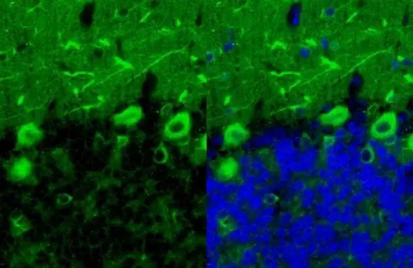 Beta III Tubulin Antibody in Immunohistochemistry (Paraffin) (IHC (P))