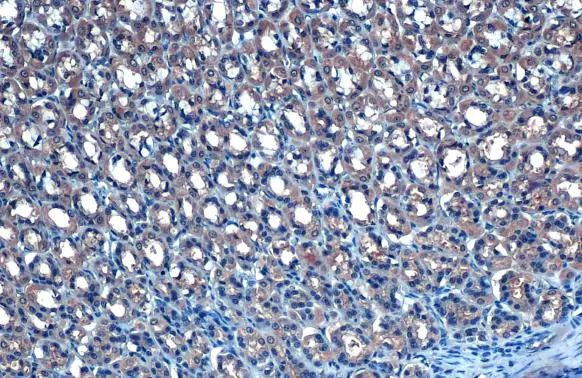 TAB2 Antibody in Immunohistochemistry (Paraffin) (IHC (P))