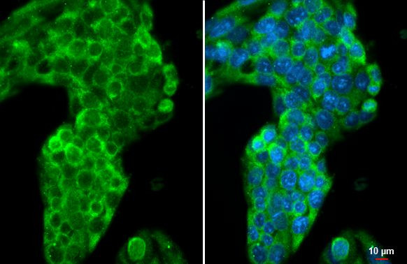 ApoA1 Antibody in Immunocytochemistry (ICC/IF)