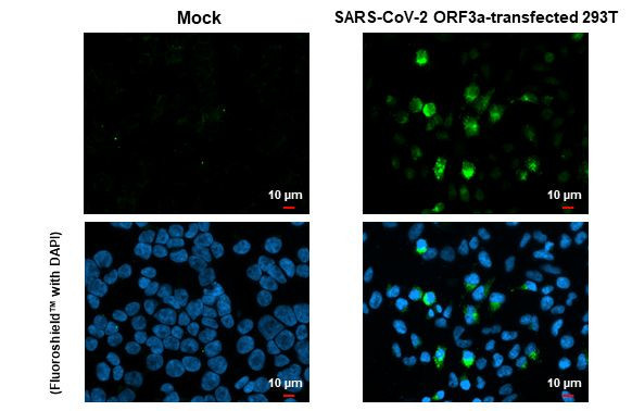 SARS-CoV-2 ORF3a Antibody in Immunocytochemistry (ICC/IF)