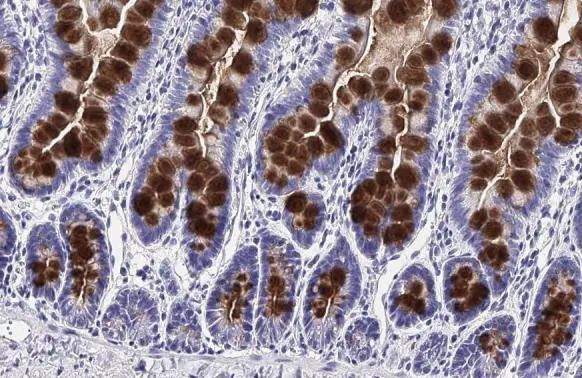 MUC2 Antibody in Immunohistochemistry (Paraffin) (IHC (P))