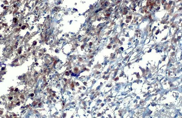 WRN Antibody in Immunohistochemistry (Paraffin) (IHC (P))