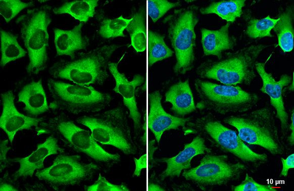 HGS Antibody in Immunocytochemistry (ICC/IF)