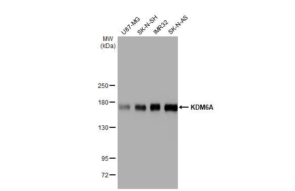 KDM6A Antibody in Western Blot (WB)