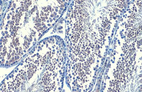 B-Raf Antibody in Immunohistochemistry (Paraffin) (IHC (P))