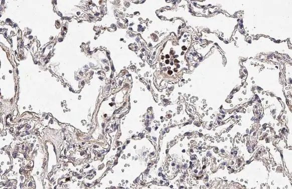 TREM2 Antibody in Immunohistochemistry (Paraffin) (IHC (P))