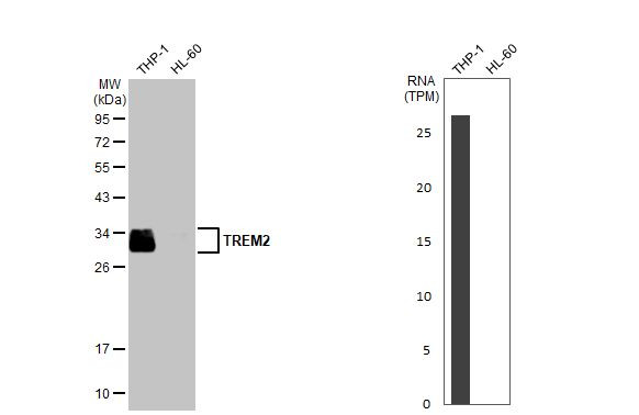 TREM2 Antibody in Western Blot (WB)