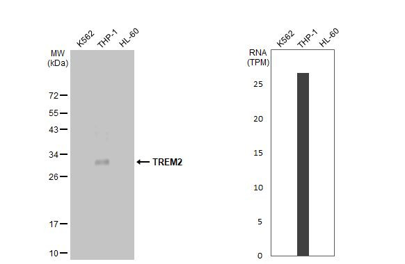 TREM2 Antibody in Western Blot (WB)