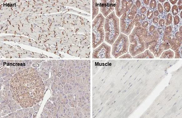 beta Catenin Antibody in Immunohistochemistry (Paraffin) (IHC (P))