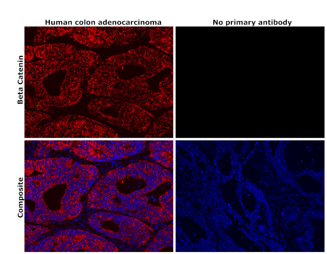 beta Catenin Antibody in Immunohistochemistry (Paraffin) (IHC (P))