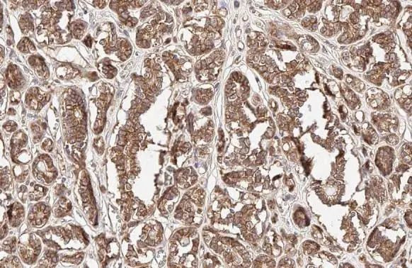 beta Catenin Antibody in Immunohistochemistry (Paraffin) (IHC (P))