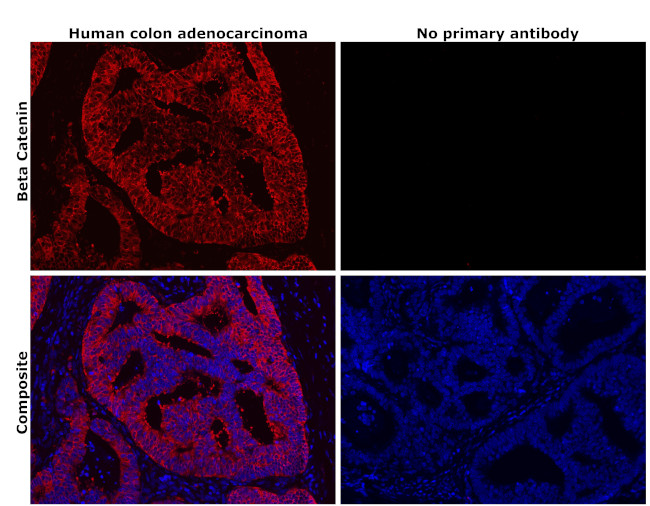 beta Catenin Antibody in Immunohistochemistry (Paraffin) (IHC (P))