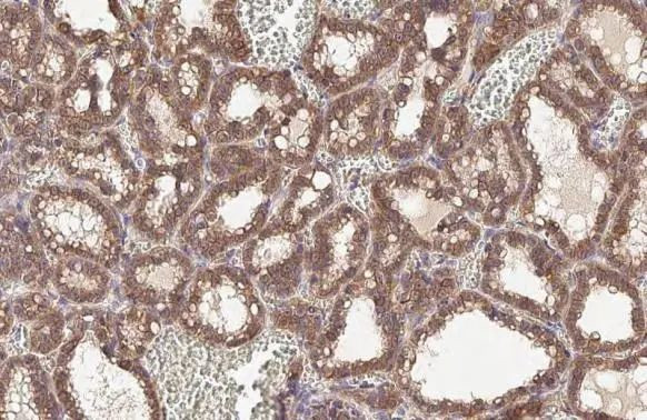 beta Catenin Antibody in Immunohistochemistry (Paraffin) (IHC (P))