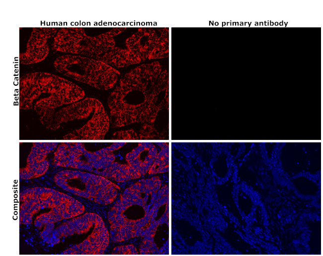 beta Catenin Antibody in Immunohistochemistry (Paraffin) (IHC (P))