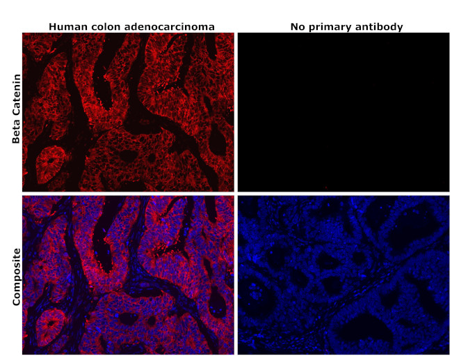 beta Catenin Antibody in Immunohistochemistry (Paraffin) (IHC (P))