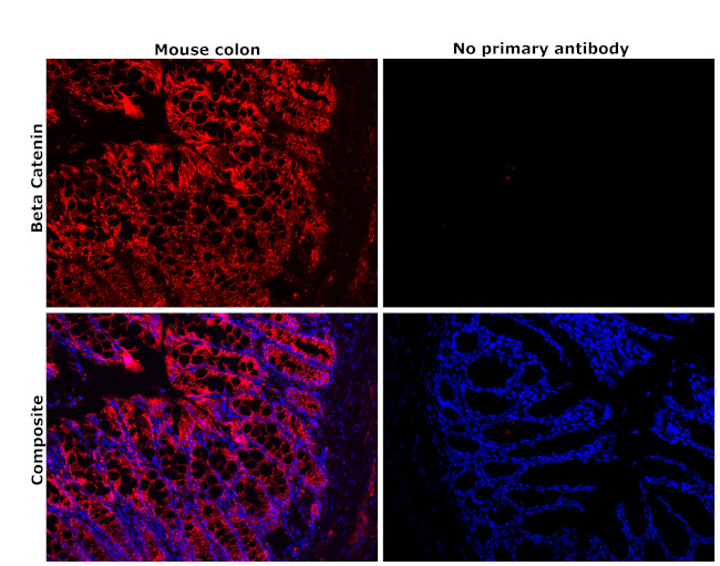 beta Catenin Antibody in Immunohistochemistry (Paraffin) (IHC (P))