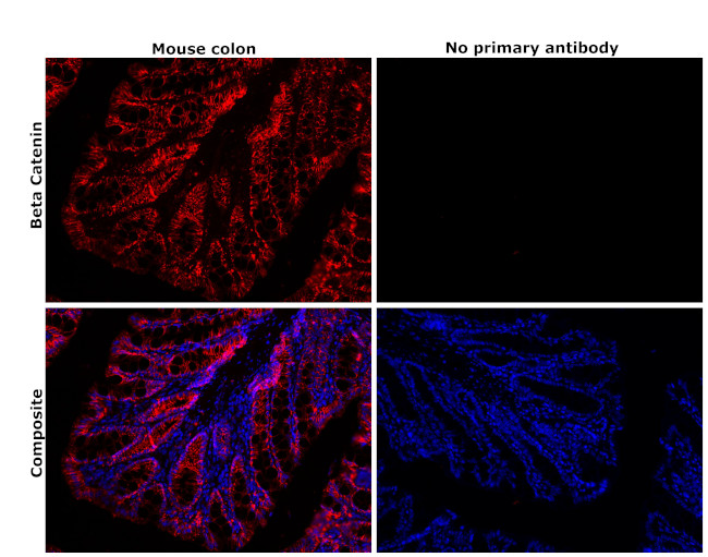 beta Catenin Antibody in Immunohistochemistry (Paraffin) (IHC (P))