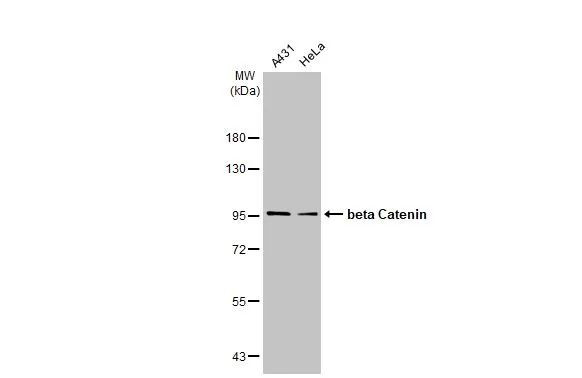 beta Catenin Antibody in Western Blot (WB)