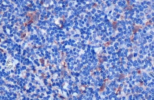 IL-18 Antibody in Immunohistochemistry (Paraffin) (IHC (P))