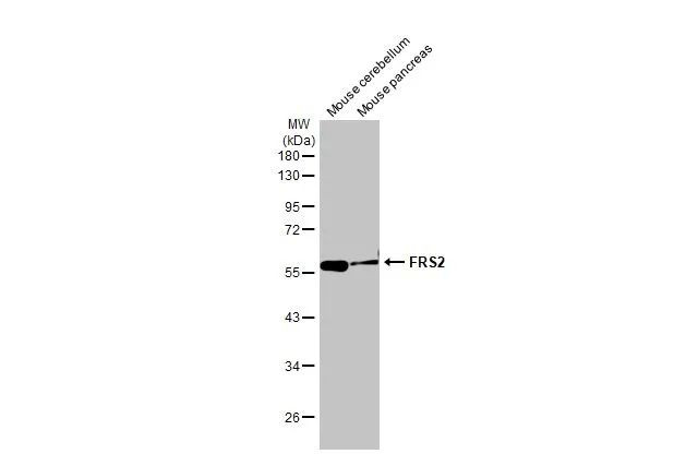 FRS2 Antibody in Western Blot (WB)