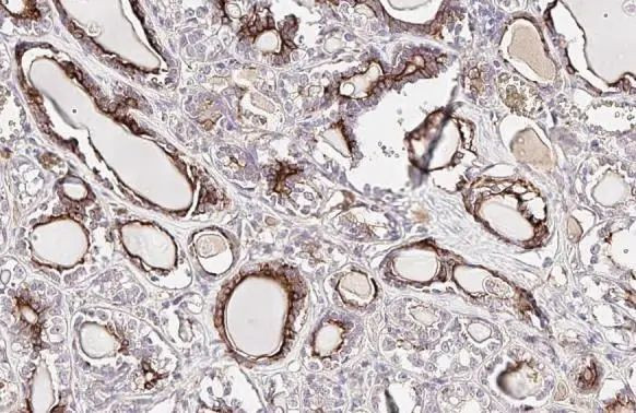 Epo Antibody in Immunohistochemistry (Paraffin) (IHC (P))