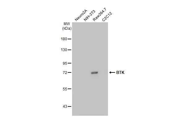 BTK Antibody in Western Blot (WB)