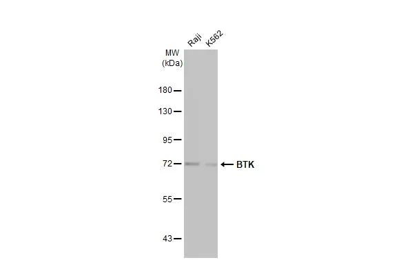 BTK Antibody in Western Blot (WB)