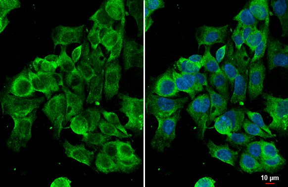 GRP78 Antibody in Immunocytochemistry (ICC/IF)